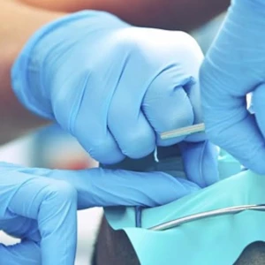 Zahnärztlich - chirurgische Maßnahmen