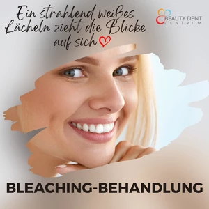 Bleaching-Behandlung